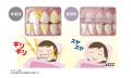 睡眠時の歯や顎への加重を軽減！自分専用のマウスピー