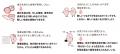 慢性腎臓病（CKD）などの治療と生活における「リフレ
