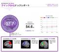 サンリオエンターテイメント、ブレンインパクトとBHQ