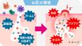 それってニキビじゃないかも？“ からだの部位 ”や“ ブ