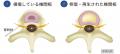 ＜先進的日帰り腰痛治療3,000件突破＞初診から治療ま