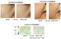 霊芝の亜臨界水抽出物が肌のDNA修復能力を高め、様々