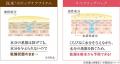 昨年6日で完売*¹した幻のリップケアアイテム『メディ