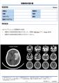 「頭部CT画像解析AIエンジンDoctorNET Heuron CTS」日