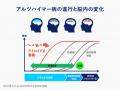 「認知症治療の最前線。パラダイムシフトの鍵は『検査