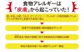 『食物アレルギーは「皮膚」が原因だった』！日本アレ
