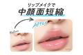明るめ粘膜カラーで唇ふっくら拡張! 中顔面短縮リップ