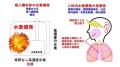 低濃度水素吸入が放射線治療の骨髄障害を抑制：白血球