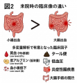 【東京医科大学】小腸出血は大腸出血より輸血・utf-8