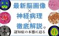 認知症の本態に迫る!書籍『認知症イメージングテキス 認知症の本態に迫る!書籍『認知症イメージングテキス