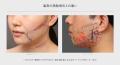 脂肪吸引専門のTHE CLINICが、顔全体をひとつの輪郭と