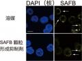 【岡山大学】ハイパーサーミアの抗腫瘍効果を大幅に向