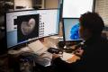3D解析ソフト「Molcer Plus 2.0」CTセグメンテーショ