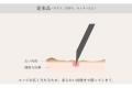 燕三条の精巧な技術が生んだ、やわらかい皮膚への負担