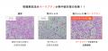 水分・塩分の補給だけでは防げない？！「熱中症utf-8
