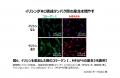 加齢で目立つ“目袋”に繋がる「下まぶたの構造変化」を 加齢で目立つ“目袋”に繋がる「下まぶたの構造変化」を