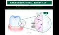 G・U・M、夜からはじめる歯周病予防の新習慣を提案 G・U・M、夜からはじめる歯周病予防の新習慣を提案