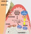 【日本大学】歯周病の増悪にウイルスが関与か 【日本大学】歯周病の増悪にウイルスが関与か