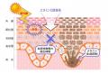 【独自研究】シミ生成に関わる微弱炎症を抑制するメカ 【独自研究】シミ生成に関わる微弱炎症を抑制するメカ