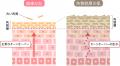 シミのもと*¹ にアプローチ、硬い角層をほぐし浸透「