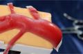 「Feel Organ 肺動脈モデル（WKA-Fe1）」の血管鞘を20