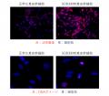 肌の幹細胞が自らを維持するメカニズムを発見　抗酸化
