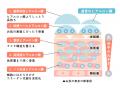 正しく知って、賢く選ぶ「ヒアルロン酸セミナー」開催