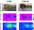 超音波で骨粗鬆症による骨の質的変化を検出 超音波で骨粗鬆症による骨の質的変化を検出