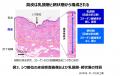シワが刻まれにくい“しなやかな真皮”に修復する鍵を発 シワが刻まれにくい“しなやかな真皮”に修復する鍵を発