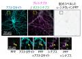 アストロサイトがパーキンソン病病理の進展を促utf-8