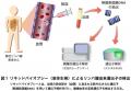 診断が難しい悪性リンパ腫を「採血」で高感度にutf-8