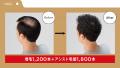 アートネイチャー 新TV-CM 　アートネイチャー史上最