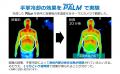 一般医療機器としてリニューアル【熱中症対策】医療機