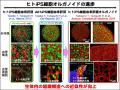 ヒトiPS細胞由来の肝臓オルガノイド移植による革utf-8