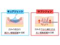 名古屋のまゆりなclinic名古屋栄でサブシジョンutf-8