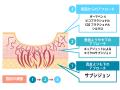 名古屋のまゆりなclinic名古屋栄でサブシジョンutf-8