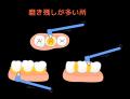 先着2,000名様限定でタフトブラシのサブスクが驚きの0
