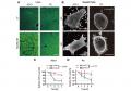 脂肪肝・肝硬変を食い止める分子モーター