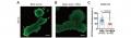 脂肪肝・肝硬変を食い止める分子モーター