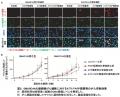 【東京医科大学】SMARCA4欠損肺腺がんに対する個utf-8