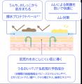 荒れやすい赤ちゃんのおしりケアに特化した密着ベール