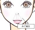 美容外科クリニック「eクリニック」が「切らない人中