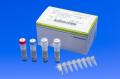 「OncoGuide(TM) EpiLight(TM)メチル化検出キット」の