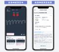 自律神経の状態やストレスをスマホで見える化アプリ「