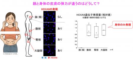 顔と身体では皮膚の弾力が異なる理由を解明～皮膚弾力
