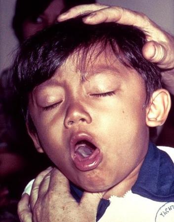 【国内での感染者数が過去最多を更新し拡大中】日本を