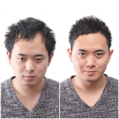 日本初の薄毛男性専門美容院「INTI（インティ）」が東