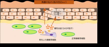 真皮の細胞老化による慢性炎症が肌表面の凹凸にutf-8