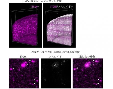 高速・高感度の多重三次元免疫組織化学法の開発に成功