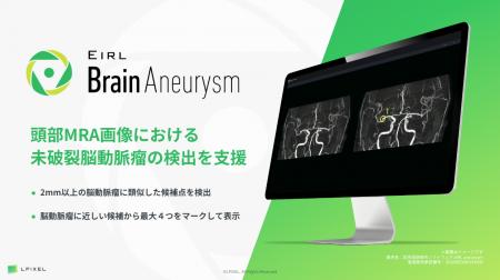 頭部MRA画像から脳動脈瘤候補点を検出するEIRL Brain 